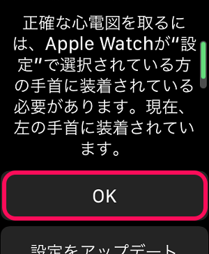 AppleWatch 心電図アプリ